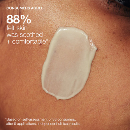 Powerbright dark spot peel